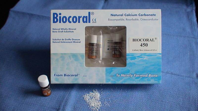 Biocoral французский препарат компании Inoteb
