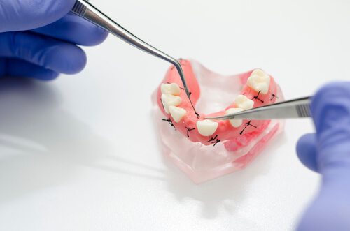 Стоматолог манипулирует с моделью челюсти со швами